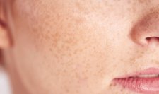 Focus on face skin Focus on face skin