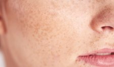 Focus on sensitive skin Focus on sensitive skin