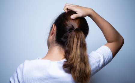 Votre Peau_Header_démangeaisons cuir chevelu_article Comment traiter la dermite séborrhéique du cuir chevelu