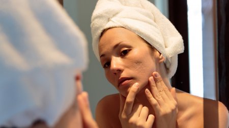 Bioderma - Adult with acne